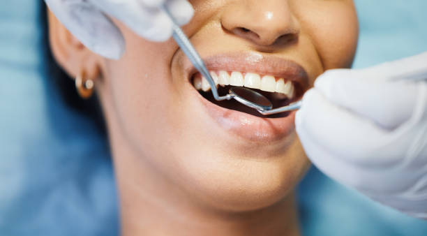 Best Emergency Wisdom Teeth Removal in Farmerville, LA